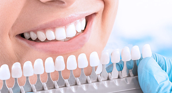 Medikal Diş Beyazlatma Nedir?